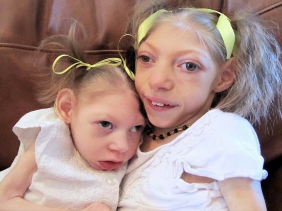 aa_2_2_l_13_TORCH_09