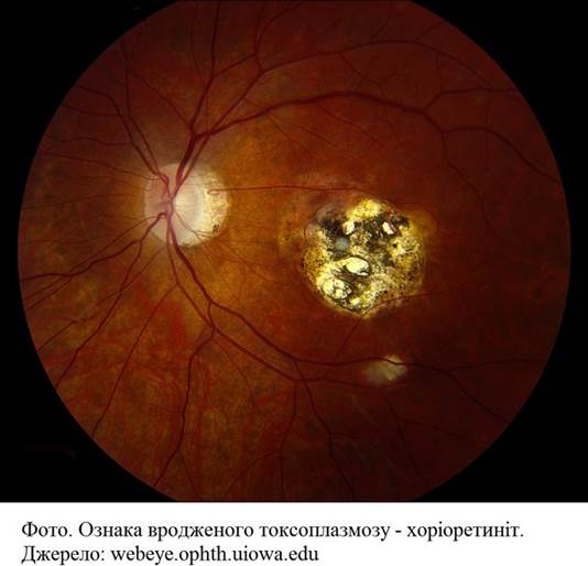 aa_2_2_l_13_TORCH_011