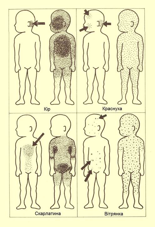 aa_2_2_l_13_TORCH_25