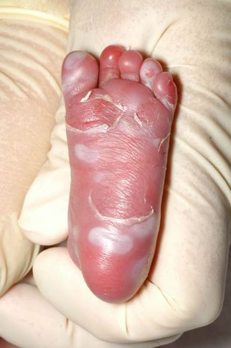 aa_2_2_l_13_TORCH_22