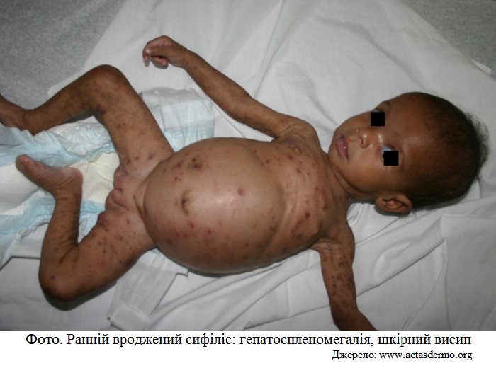 aa_2_2_l_13_TORCH_33