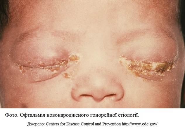 aa_2_2_l_13_TORCH_018