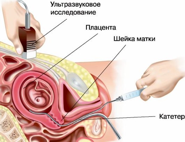 Реферат: Харчування жінки під час вагітності