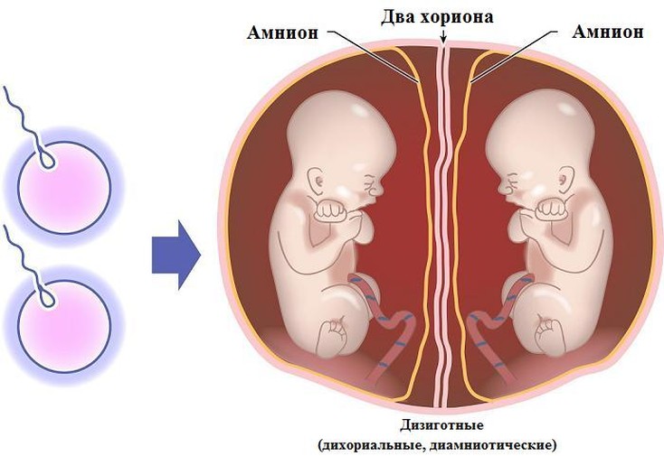 Реферат: Спосіб лікування бактеріального вагінозу у вагітних з невиношуванням вагітності